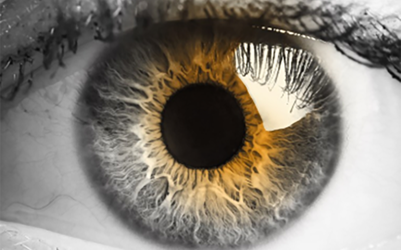 Close up image of eyeball 