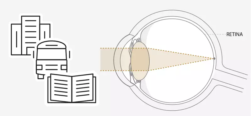 Diagram of eye