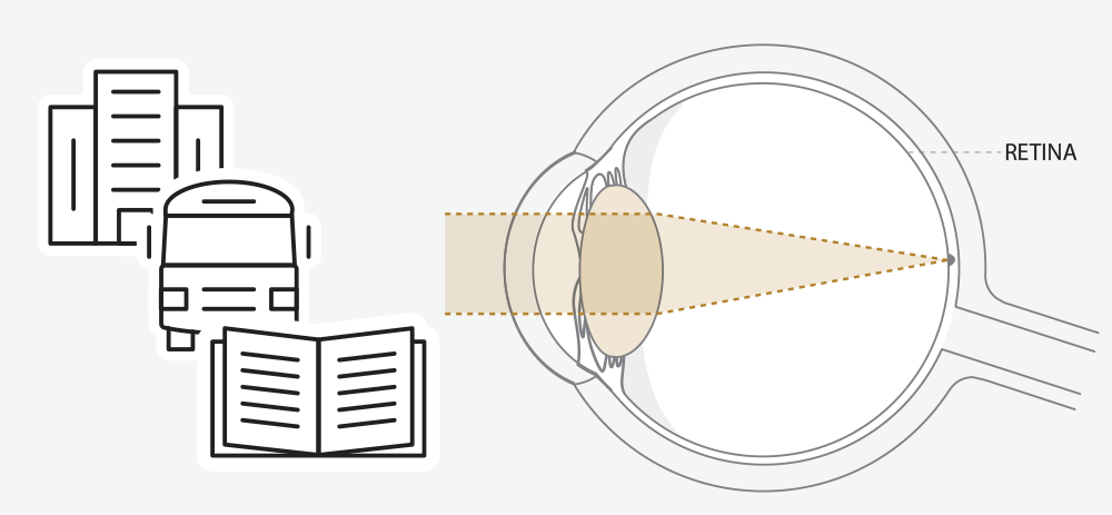 Diagram of eye