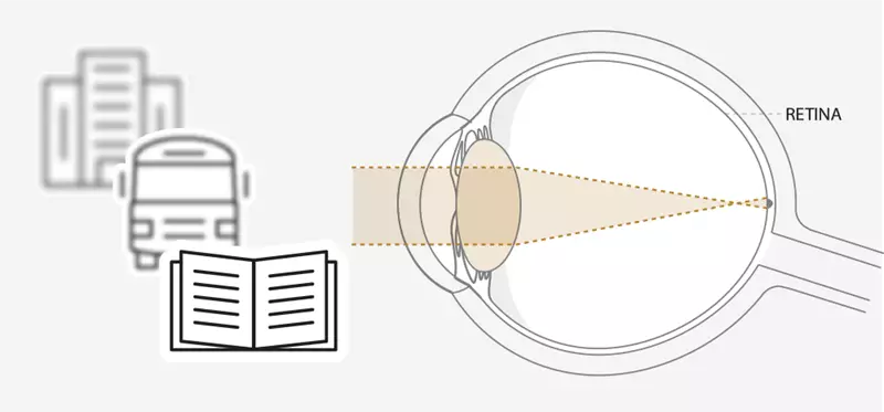 Diagram of eye