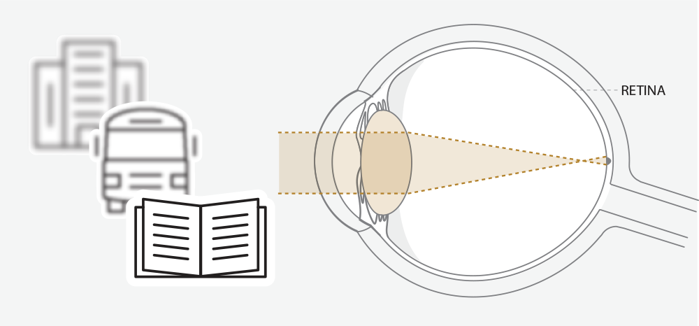 Diagram of eye
