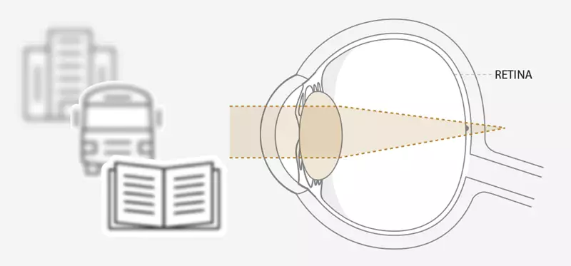 Diagram of eye