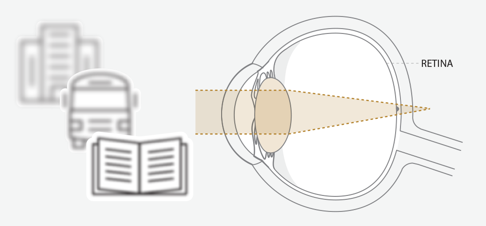 Diagram of eye