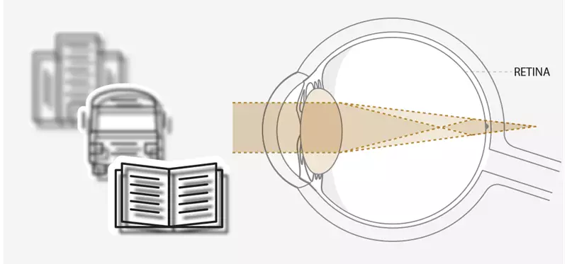 Diagram of eye