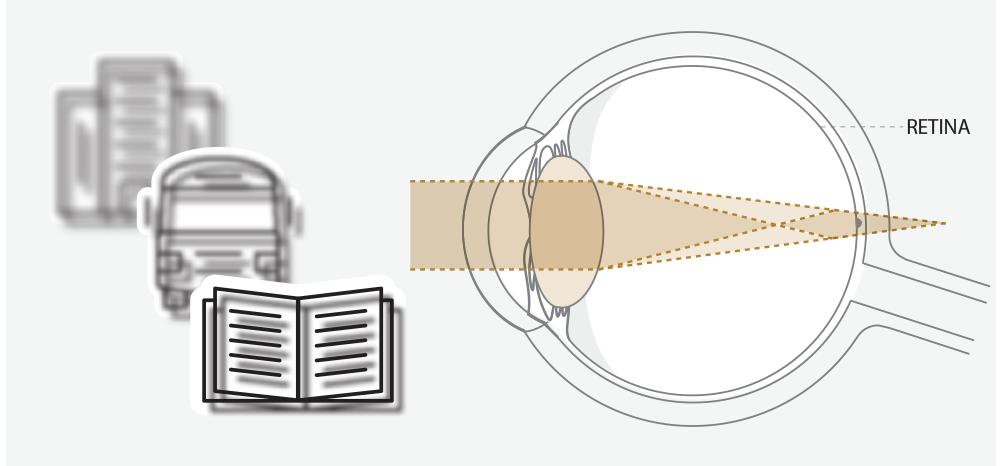 Diagram of eye