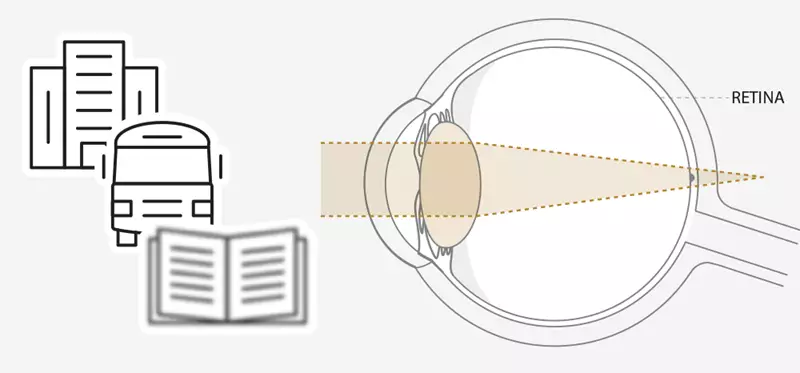 Diagram of eye