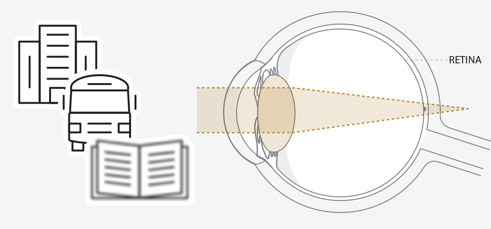 Diagram of eye